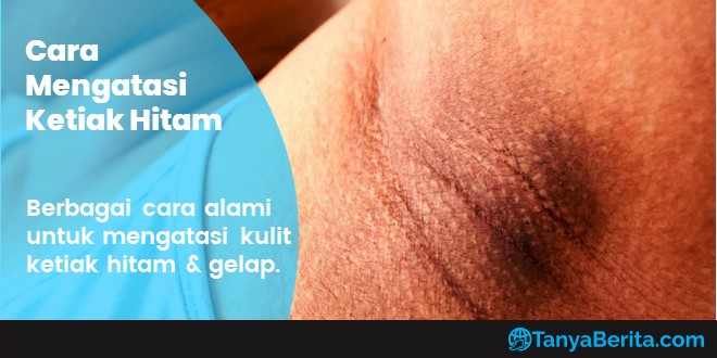Cara Memutihkan Ketiak yang Hitam Secara Alami, Cepat dan Mudah Dilakukan