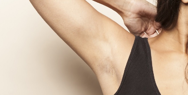 Deodorant untuk Memutihkan Ketiak