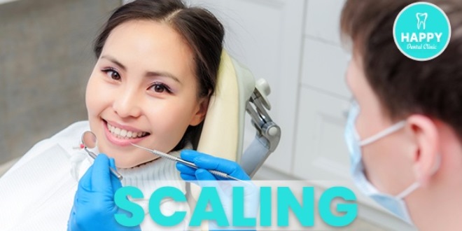 Perawatan Scaling Gigi