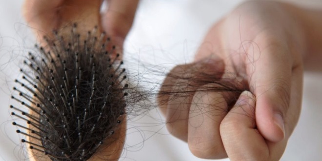 Solusi Rambut Rontok dan Ketombe Kenali Penyebab dan Cara Mengatasinya