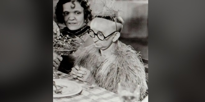 Kisah Koo Koo The Bird Girl Perjalanan Hidup Minnie Woolsey yang Menginspirasi